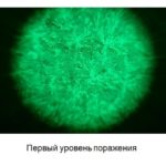 Первичное поражение